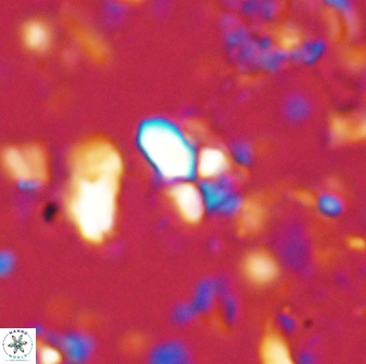 Sphenolithus anarrhopus 43038