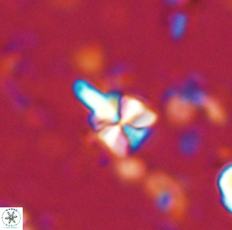 Sphenolithus anarrhopus 43122