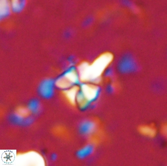 Sphenolithus anarrhopus 43123