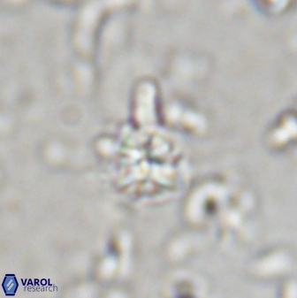 Sphenolithus anarrhopus 43127