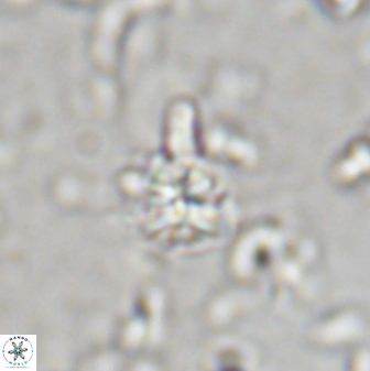 Sphenolithus anarrhopus 43127