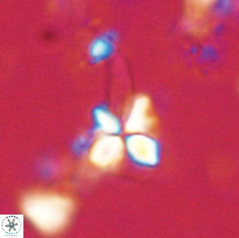 Sphenolithus anarrhopus 60701