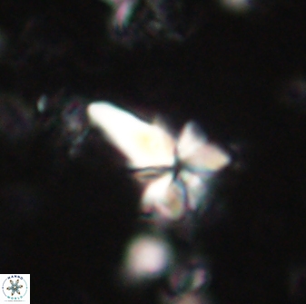 Sphenolithus anarrhopus 60703