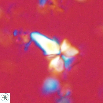Sphenolithus anarrhopus 60704