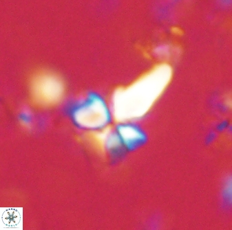 Sphenolithus anarrhopus 60705