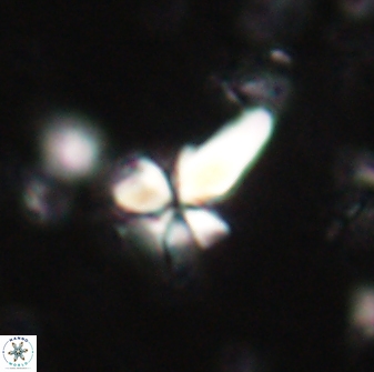 Sphenolithus anarrhopus 60706