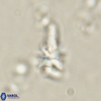 Sphenolithus anarrhopus 60707