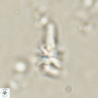 Sphenolithus anarrhopus 60707