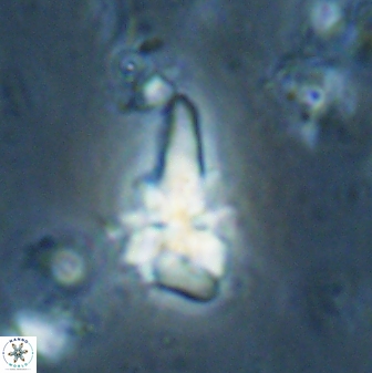 Sphenolithus anarrhopus 60708