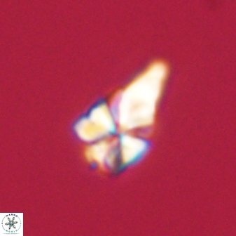 Sphenolithus anarrhopus 61278