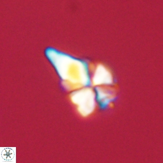 Sphenolithus anarrhopus 61281