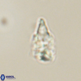 Sphenolithus anarrhopus 61287