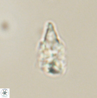 Sphenolithus anarrhopus 61287