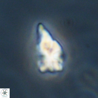 Sphenolithus anarrhopus 61285