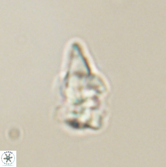 Sphenolithus anarrhopus 61286