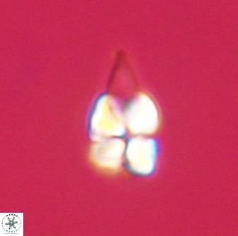 Sphenolithus anarrhopus 61288