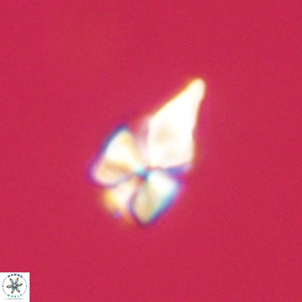 Sphenolithus anarrhopus 61292