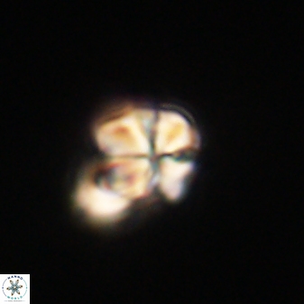 Sphenolithus anarrhopus 61297