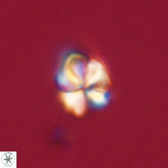 Sphenolithus anarrhopus 61295