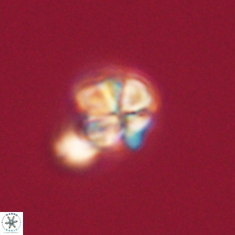 Sphenolithus anarrhopus 61296