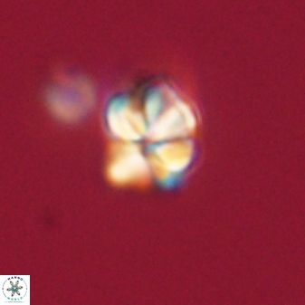 Sphenolithus anarrhopus 61299