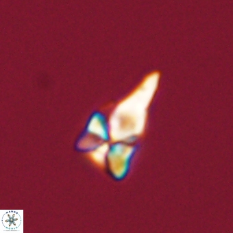 Sphenolithus anarrhopus 67963