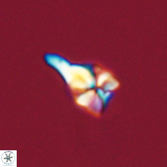 Sphenolithus anarrhopus 67967