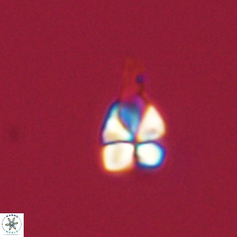 Sphenolithus anarrhopus 67970