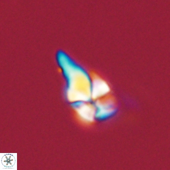 Sphenolithus anarrhopus 67978