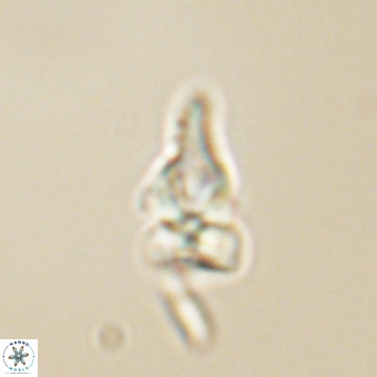 Sphenolithus anarrhopus 67989