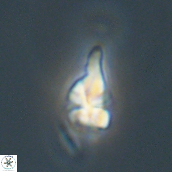 Sphenolithus anarrhopus 67990