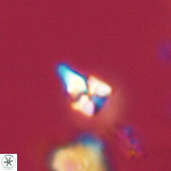 Sphenolithus anarrhopus 68659