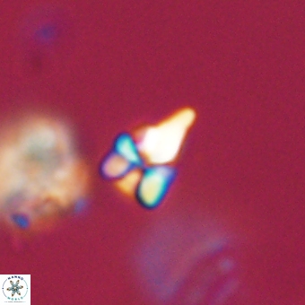 Sphenolithus anarrhopus 68662