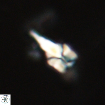 Sphenolithus anarrhopus 68993
