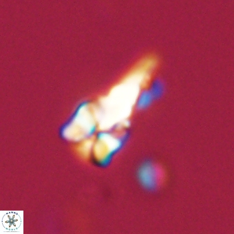 Sphenolithus anarrhopus 68991