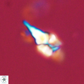 Sphenolithus anarrhopus 68994