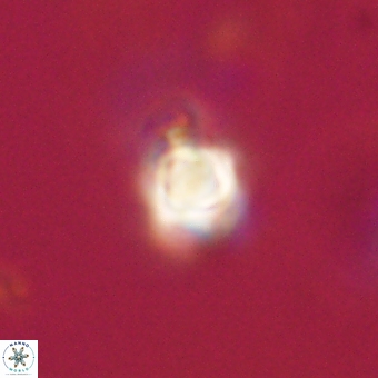 Sphenolithus anarrhopus 69001
