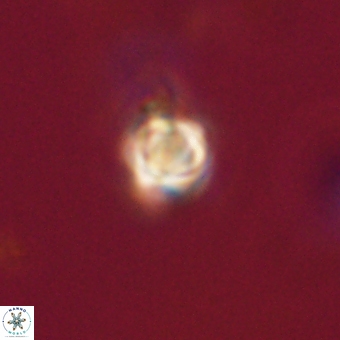 Sphenolithus anarrhopus 69005