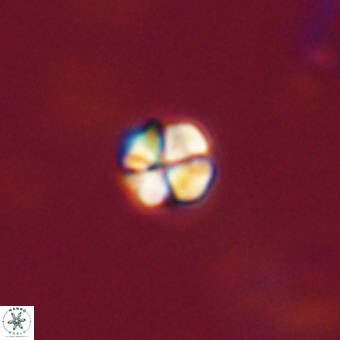 Sphenolithus anarrhopus 69006