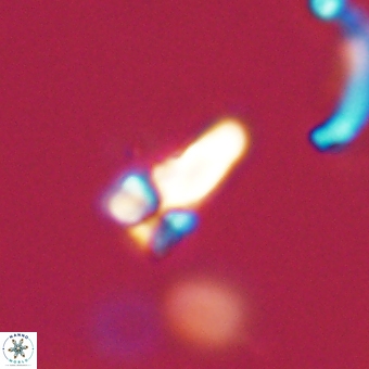 Sphenolithus anarrhopus 69184