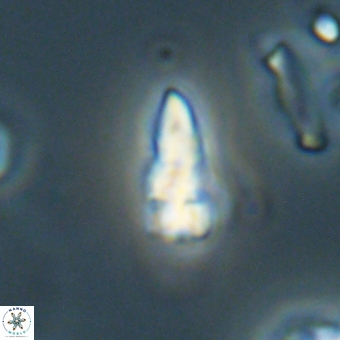 Sphenolithus anarrhopus 69188