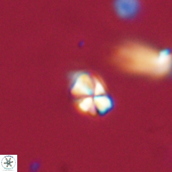 Sphenolithus anarrhopus 69193