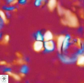 Sphenolithus ankathias 22275