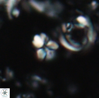 Sphenolithus ankathias 22276
