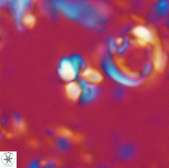 Sphenolithus ankathias 22277
