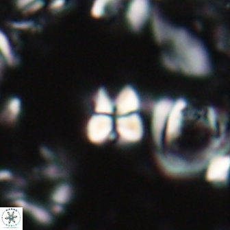 Sphenolithus ankathias 22273