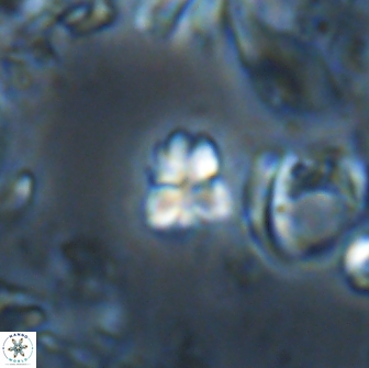 Sphenolithus ankathias 22284