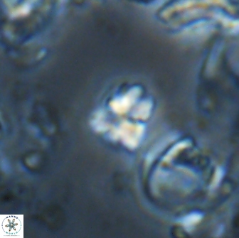 Sphenolithus ankathias 22285