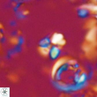 Sphenolithus ankathias 22280