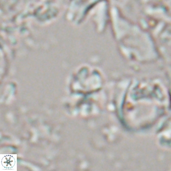 Sphenolithus ankathias 22283